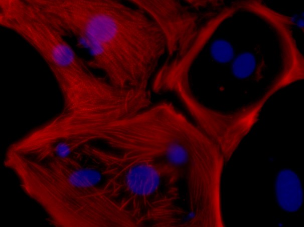 55e35-20110130_cardiomyocytes