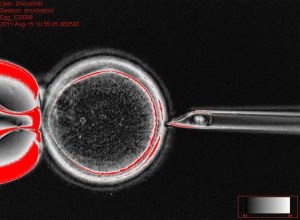 The technique for removing the nucleus from an egg [Courtesy Oregon Health Sciences University ]