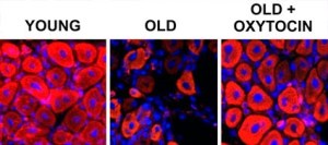 The healthy muscle tissue on the left is from a young mouse. The addition of oxytocin to the blood of old mice rapidly rejuvenates the old muscle, as shown on the right. (Credit: Wendy Cousin and Christian Elabd, UC Berkeley)