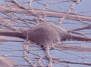 Scanning electron micrograph of cultured human neuron from induced pluripotent stem cell.  [Credit: Mark Ellisman and Thomas Deerinck, National Center for Microscopy and Imaging Research, UC San Diego] 