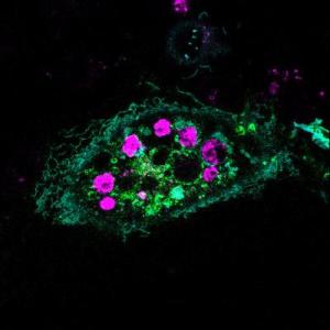 A healthy cell (green) that has recognized and engulfed dying cells (purple) is shown. [Credit: Toru Komatsu/University of Tokyo]