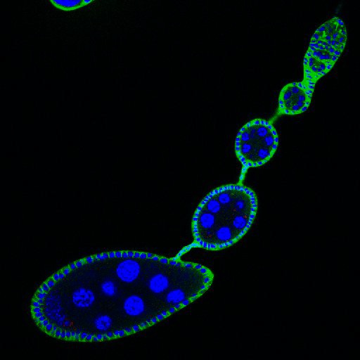 Megan Handley, a Creativity student in the Denise Montell lab at UCSB, snapped this image of a Drosophila ovariole(egg string) taken in fluorescence microscopy. The blue is DAPI(stains nucleus, and the green is anti-HTs(stains membranes). 