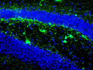 Transplanted cells (shown in green) in the hippocampus, 3 months after transplantation.  Cell nuclei are labeled in blue.  [Credit: Leslie Tong and Yadong Huang/Gladstone Institutes]