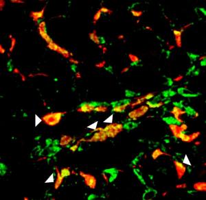 Scar forming cells (in red) in a region of the injured heart expressing blood vessel cell marker in green and thus appearing yellow (see arrows). This study observed that approximately a third of the scar-forming cells in the injured region of the heart adopted "blood vessel" cell-like characteristics. [Credit: Dr. Arjun Deb/Nature]