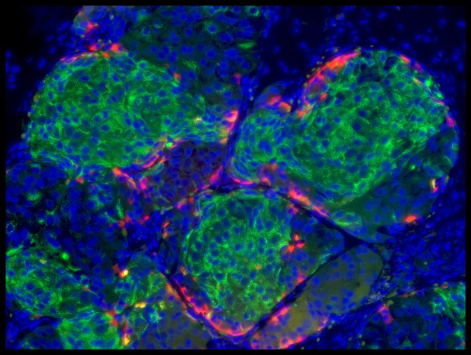 Human stem cell-derived beta cells that have formed islet like clusters in a mouse. Cells were transplanted to the kidney capsule and photo was taken two weeks later by which time the beta cells are making insulin and have cured the mouse's diabetes. [Credit: Douglas Melton] 