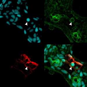 Pictured: sections from zebrafish embryos. Blood vessels are labeled in red, the protein complex that regulates inflammation green and cell nuclei in blue. The arrowhead indicates a potential HSC. The image at bottom right combines all channels. [Credit: UC San Diego School of Medicine] 