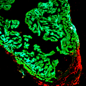 New cells (red) repairing injury in a zebra fish heart.