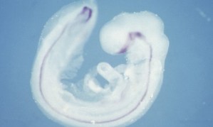 Scientists have found a way to grow spinal cords from embryonic stem cells in a petri dish. [Credit: Abigail Tucker/ MRC Centre for Developmental Neurobiology/ Wellcome Images.]