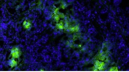 Insulin-producing cells shown in green surviving after transplant because of the new procedure.