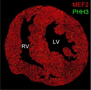 A young mouse heart with resting heart muscle cells (red) and proliferating muscle cells (green)