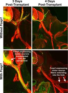 These images reveal the significance of the 'Foxp1 effect.' The Foxp1 transcription factor is crucial to the normal growth and function of motor neurons involved in limb-movement. 