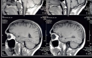 shutterstock_30402241