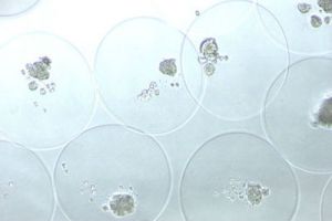 Mesenchymal stem cells captured in microcapsules