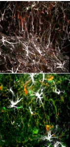Young brain cells (top) show little of the molecule that impairs stem cell function (green) that is abundant in old cells (bottom).