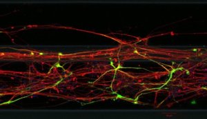 Nerve cells made from skin cells. Credit: Luxembourg Centre for Systems Biomedicine (LCSB), 2015