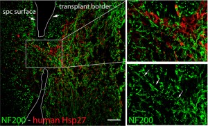 Transplant human neurons (red) provide a bridge for the mice nerve fibers (green) to enter the spinal cord (spc). Image credit Hoeber et al. Scientific Reports 