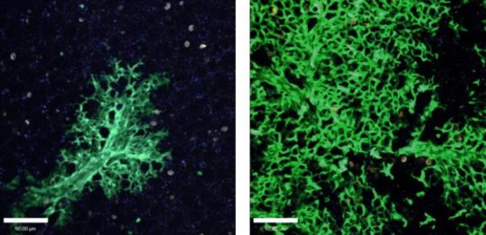 Transplanted lung cells continued to grow at six weeks (left) and 16 weeks (right).