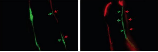 Fluorescent imaging mouse spines. Treatment with NELL-1 (right) shows greater bone formation compared to untreated mice (left). Credit: Broad Stem Cell Research Center