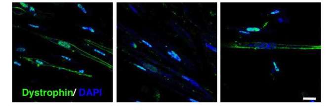 Healthy muscle cells express dystrophin (green), not cells from DMD patients (middle), but treated stem cells from patients do (right) 