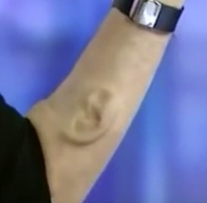 ear on arm jpeg