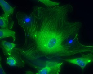 Smooth muscle cells grown from embryonic stem cells (courtesy Sanford-Burnham Institute).