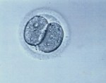 2-cell embryo