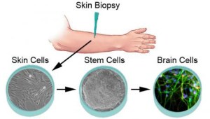 induced_neuron_process