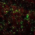 Neural stem cells (green) migrate throughout a brain and mature into astrocytes (red).