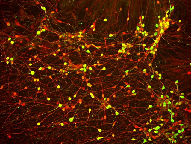 Neurons generated from FTD patient iPSCs. (Image courtesy of Helen Fong)