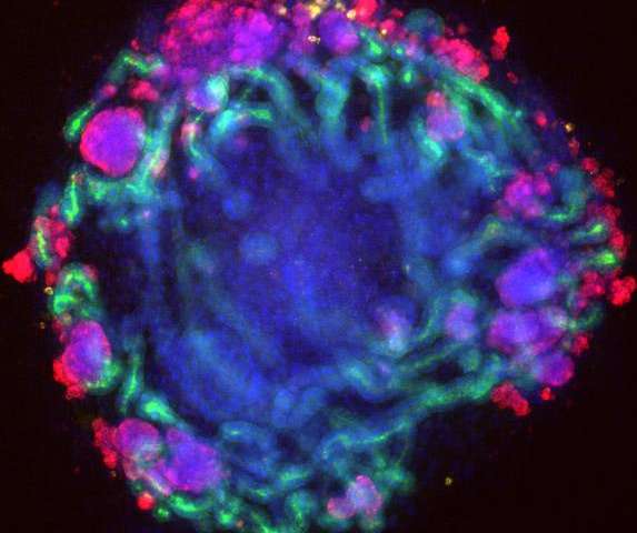 A mini-kidney (1mm diameter) grown from a patient's stem cells.