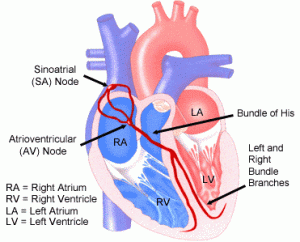Diagram of the heart depicting the Sinoatrial Node. (Image from Texas Heart Institute.