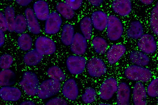 Primed human embryonic stem cells (purple) identified by a green stem cell surface marker. (Image courtesy of UCLA)