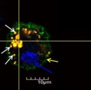 Mesenchymal stem cells loaded with drug-containing microparticles. Credit: Jeff Karp and Oren Levy, Brigham and Women's Hospital