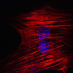 Chemically reprogrammed heart cell from skin. (Gladstone)