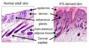 normal-and-ips-skin