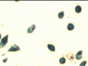 MSCs with iron nanoparticles