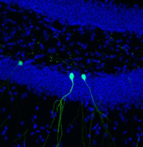 Newly generated neurons (green) send out branched dendritic extensions to make connections with other neurons. (Image credit: Salk Institute)