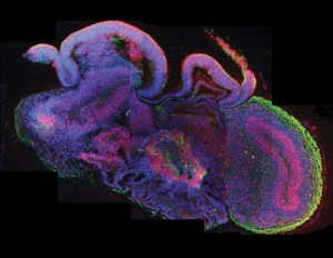 Cross section of a brain organoid. (MIT Tech Review)