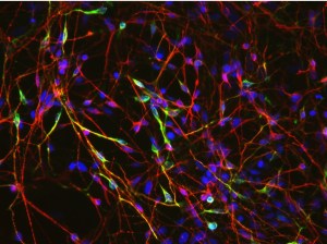 Dopaminergic neurons derived from induced pluripotent stem cells. (Xianmin Zeng, Buck Institute)