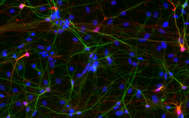 Autistic neurons Muotri