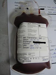blood stem cell transplant