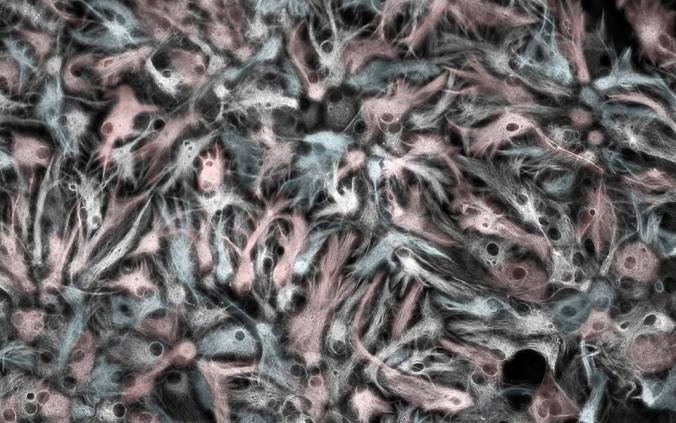 "Icy Astrocytes" by Samantha Yammine