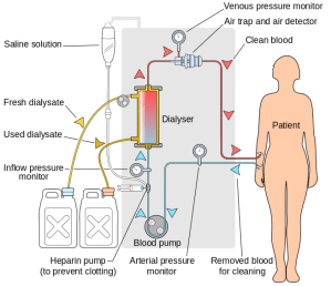Hemodialysis acts as an artificial kidney to filter the blood of kidney disease patients. (wikipedia)