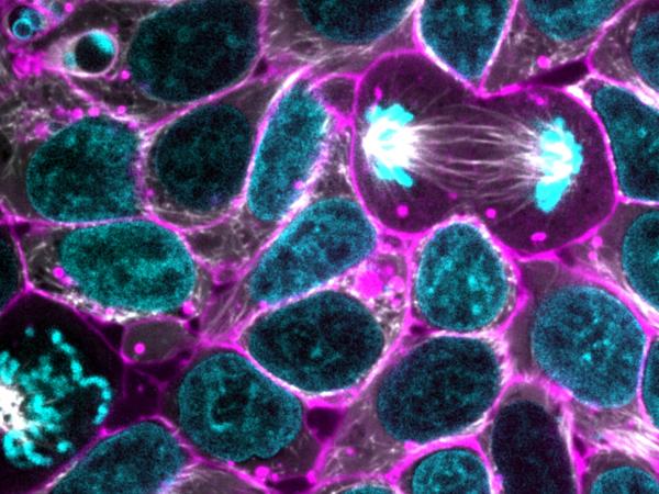 Glowing human stem cells. The edges of the cells are shown in purple while the DNA in the cell’s nucleus is in blue. (Allen Institute for Cell Science).
