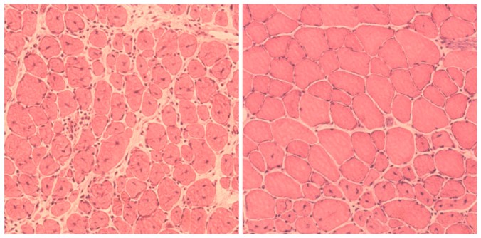 (Left) impaired muscle repair in aged mice; (right) improved muscle regeneration in aged mice subjected to reprogramming. (Salk Institute)