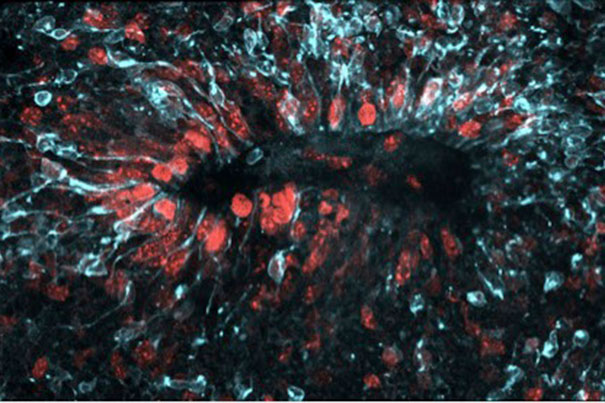 Caption: Zika virus (light blue) spreads through a three-dimensional model of a developing brain. Image by Max Salick and Nathaniel Kirkpatrick/Novartis