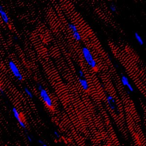 Ventricular heart muscle cells. Image courtesy of Dr. Michael Laflamme