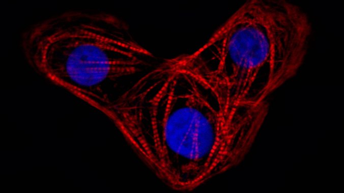 © Gladstone Institutes photo credit: Kim Cordes / Gladstone Institute Lay Description: In this image, human embryonic stem cells have been differentiated into cardiomyocytes, or heart muscle cells, and stained to show the expression of cardiac Troponin T (red), a protein that helps cardiomyocytes to contract, and cell nuclei (blue). Scientific Description: Cultured human iPSCs reprogrammed into CMs. Stain for cTnT (red), and DAPI (blue). Original caption: cardiomyocytes.tif