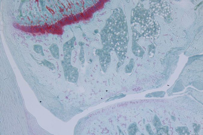 JointCartilege_nancy_liu-824x549