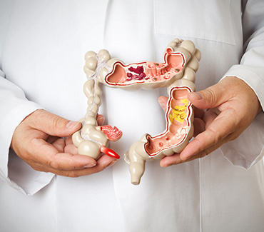 About_Bowel_Cancer_What-is-Bowel-Cancer_370newfinal